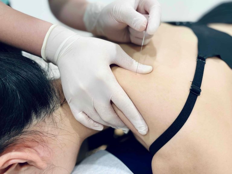 Close up of gloved hands performing dry needling